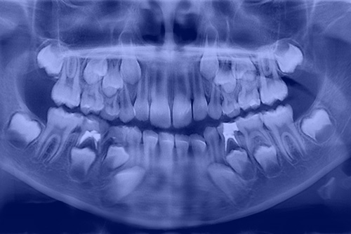 https://orthodontics.net/wp-content/uploads/2020/01/ortho-101-c.jpg